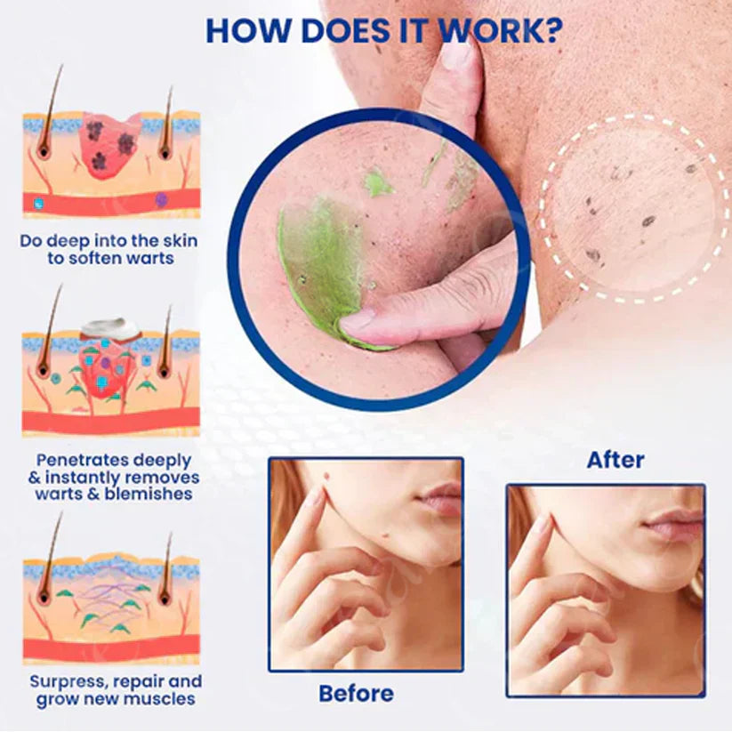 Solución para granos y cicatrices: exfoliante salicílico al 2 % + esencia VC de alta potencia