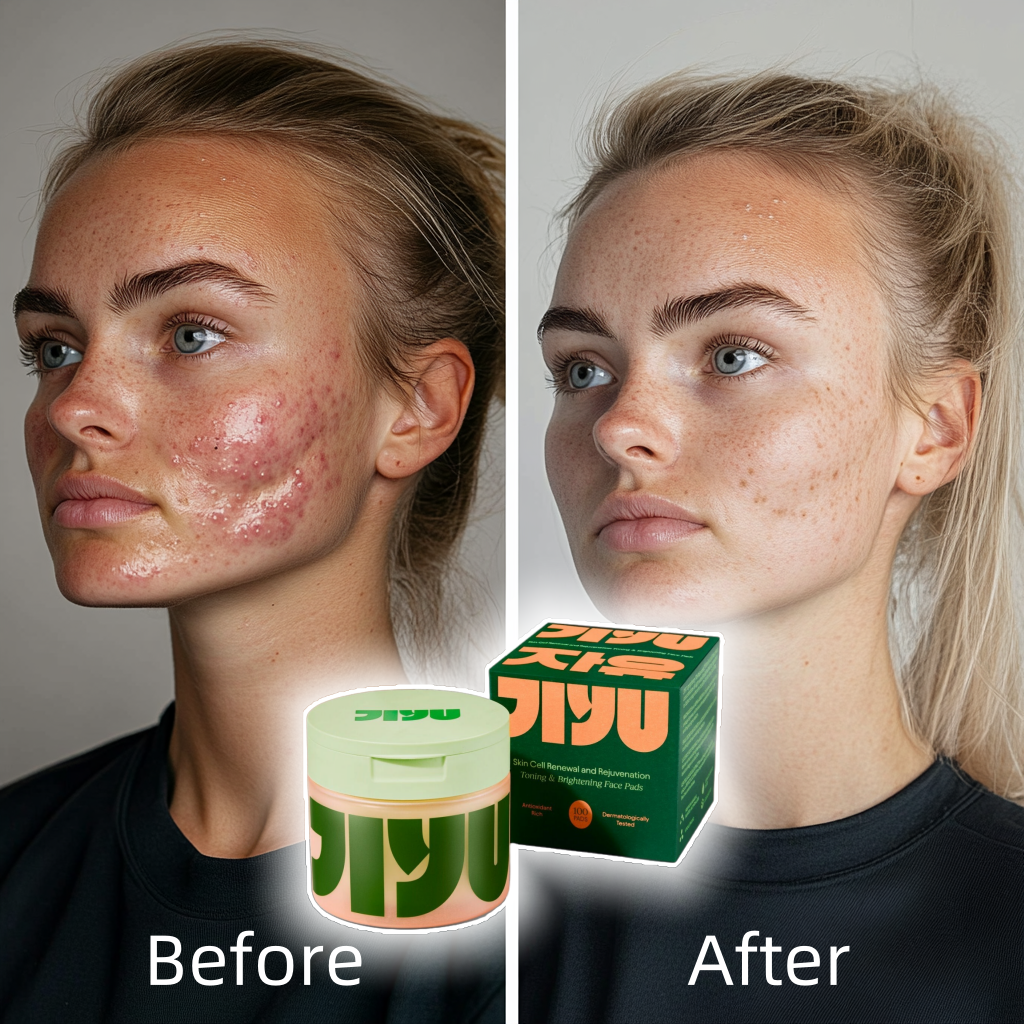 Koreanische Hautpflege-Toner-Pads – Anti-Aging, Pflege gegen dunkle Flecken und Falten mit Schneckenschleim und Peptiden (100 Stück)