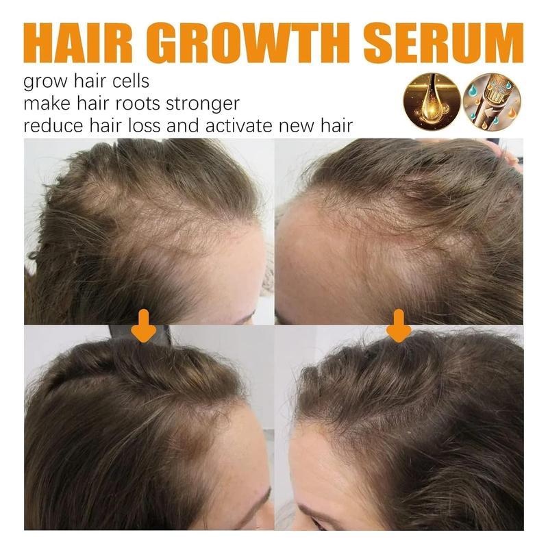 Estimulante del cuero cabelludo con jengibre | Suero para el crecimiento del cabello 