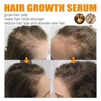 Estimulante del cuero cabelludo con jengibre | Suero para el crecimiento del cabello 