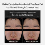 Mirco Pore Pads (AHA + BHA) | Cuidado de la piel propensa al acné