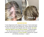 Estimulante del cuero cabelludo con jengibre | Suero para el crecimiento del cabello 