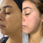 Éternelle Lumière Collagen Spot-Correction & Youth Renewal Collection