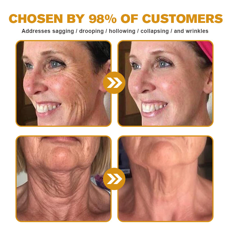 Botox Bee Venom Wrinkle Removal Cream-Last Day Promotion 75% OFF