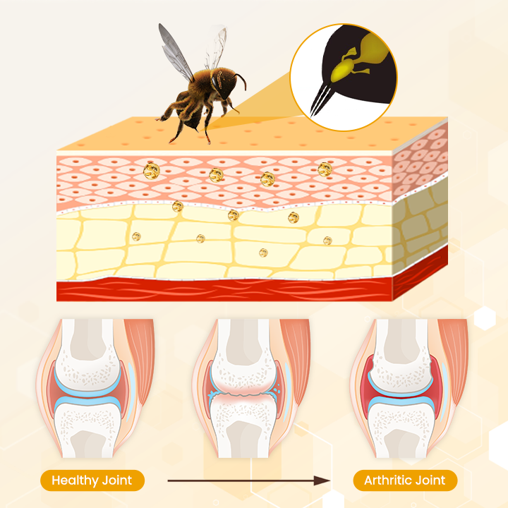 Crema para el alivio de las articulaciones con veneno de abeja OrthoRestore