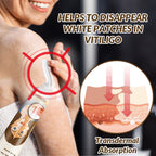Crema reparadora para el vitíligo 