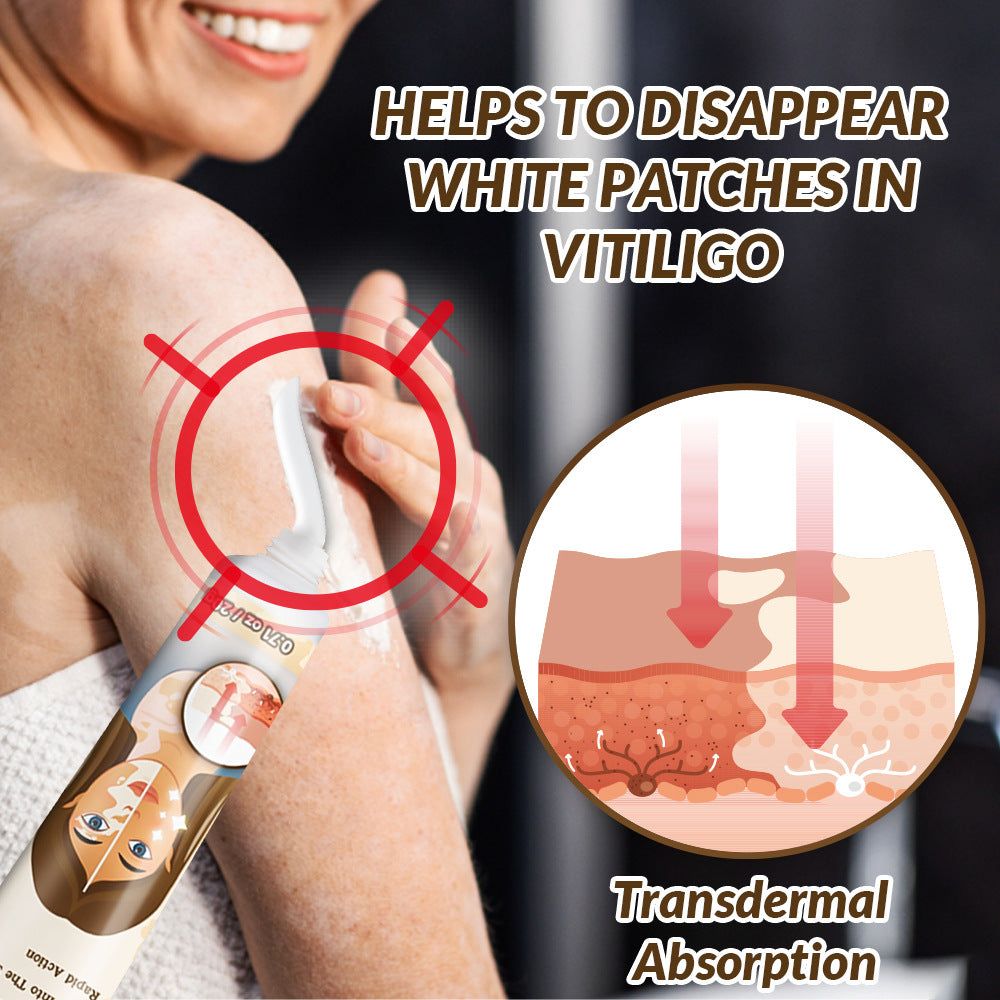 Crema reparadora para el vitíligo 