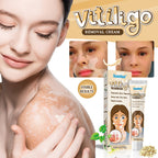 Crema reparadora para el vitíligo 