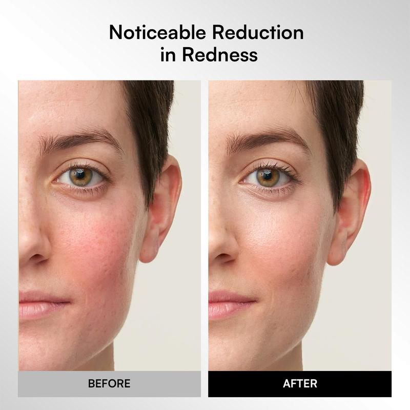 Máscara facial LED inalámbrica GLOW, portátil y recargable 