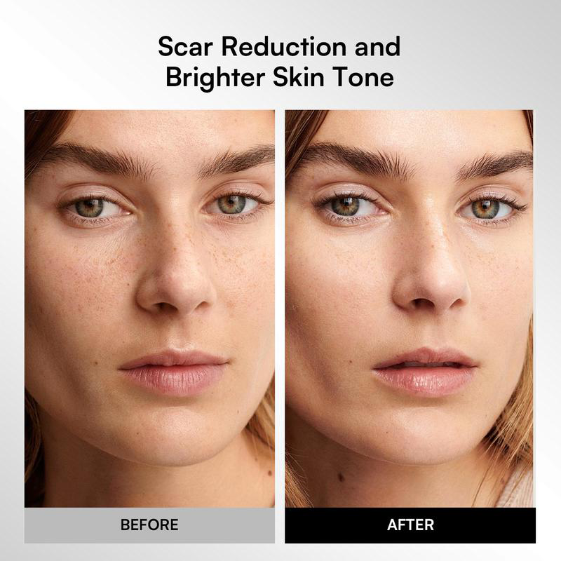 Máscara facial LED inalámbrica GLOW, portátil y recargable 