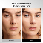 Máscara facial LED inalámbrica GLOW, portátil y recargable 