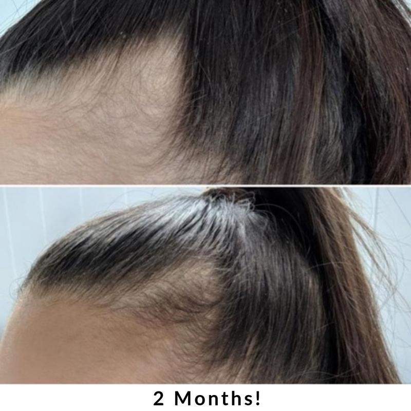 Vitaminas para el crecimiento del cabello Hair + Energy Formula 