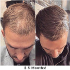 Vitaminas para el crecimiento del cabello Hair + Energy Formula 