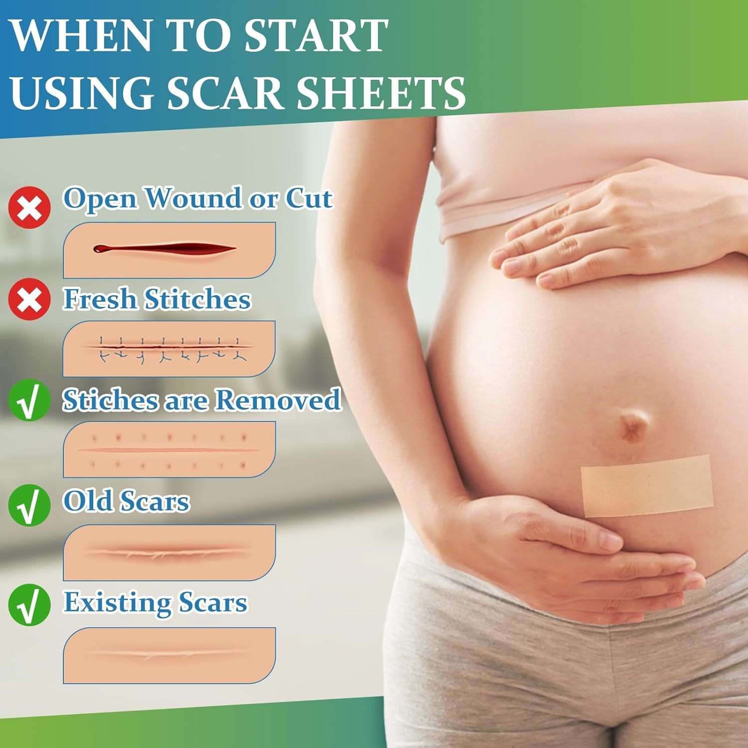 Kit de solución para cicatrices: gel crema para cicatrices + cinta de silicona para cicatrices