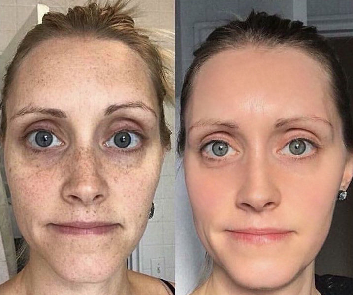 Éternelle Lumière Collagen Spot-Correction & Youth Renewal Collection