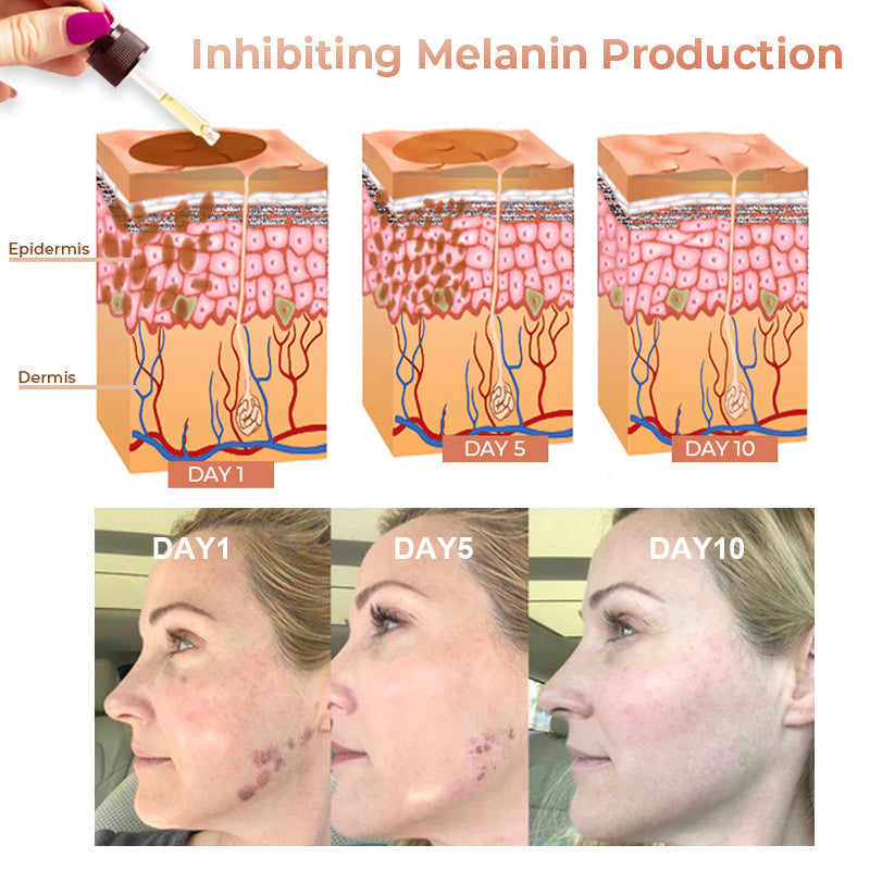 Fast Dark Spot Remover-Melanin Correcting Facial Serum