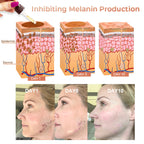 Fast Dark Spot Remover-Melanin Correcting Facial Serum