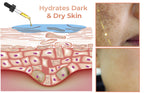 Fast Dark Spot Remover-Melanin Correcting Facial Serum