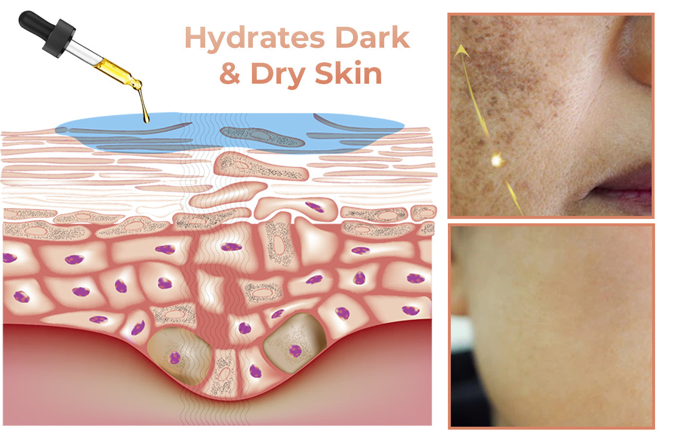 Fast Dark Spot Remover-Melanin Correcting Facial Serum