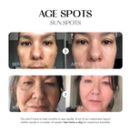 Dark Spot Corrector