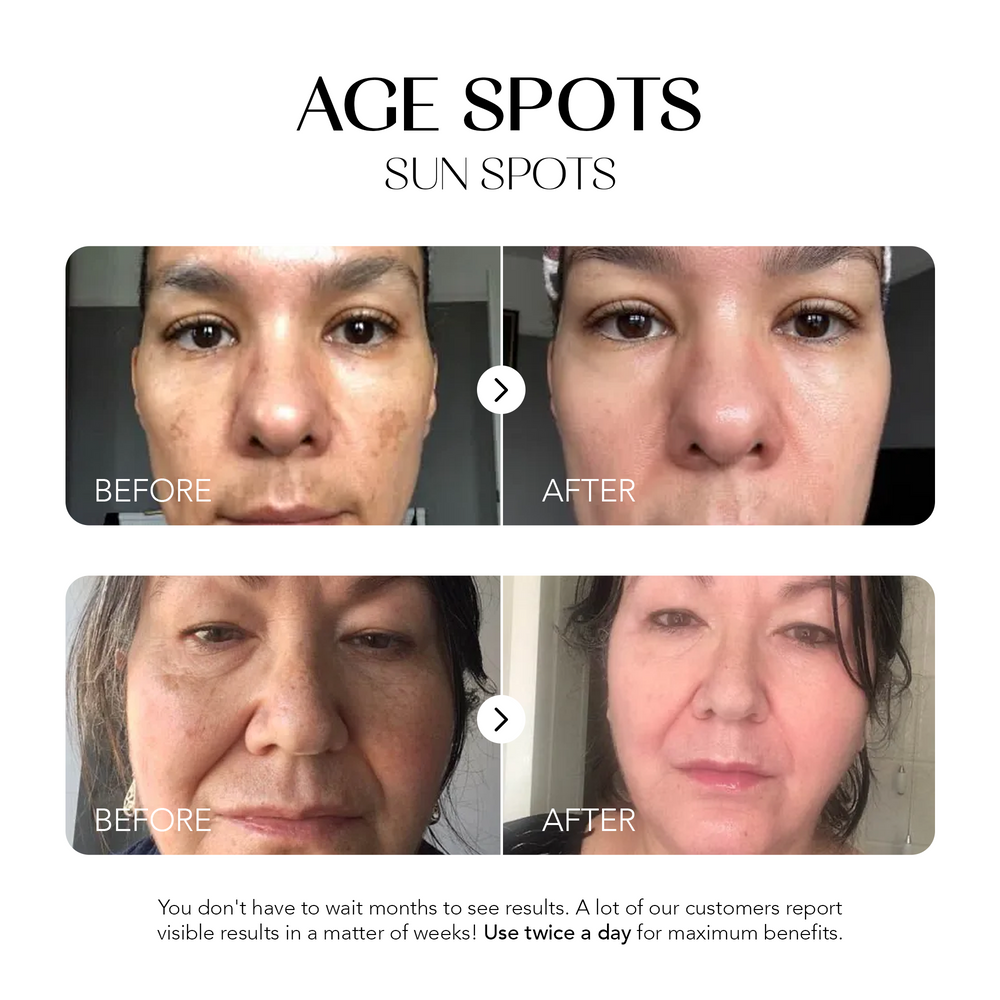 Dark Spot Corrector