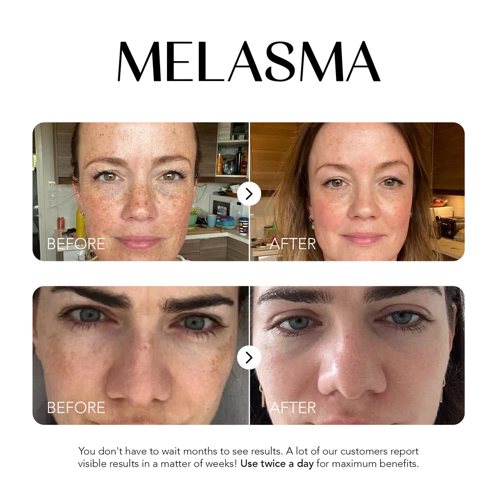 Dark Spot Corrector