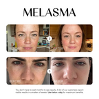 Dark Spot Corrector
