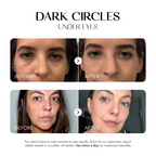 Dark Spot Corrector