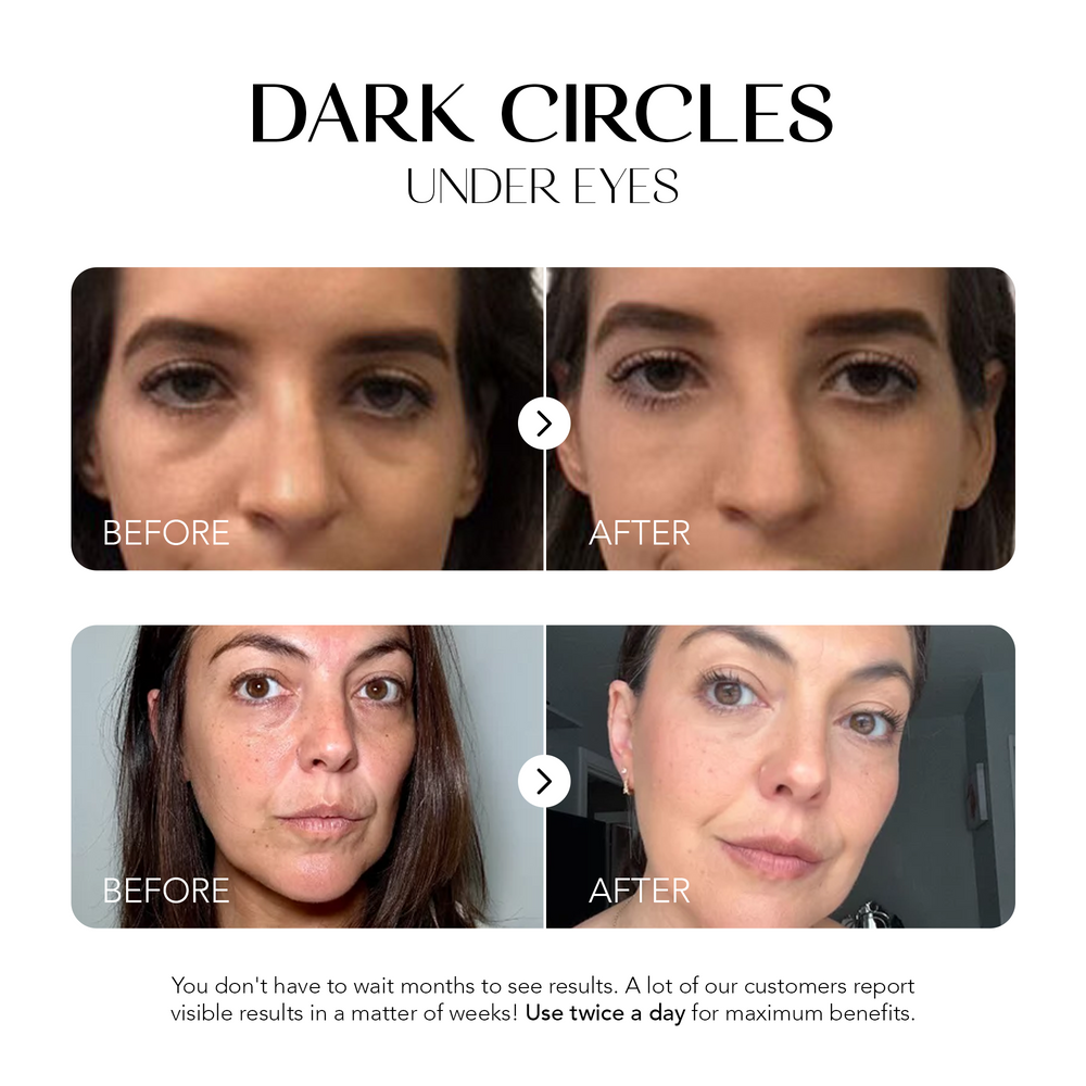 Dark Spot Corrector