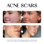 Dark Spot Corrector