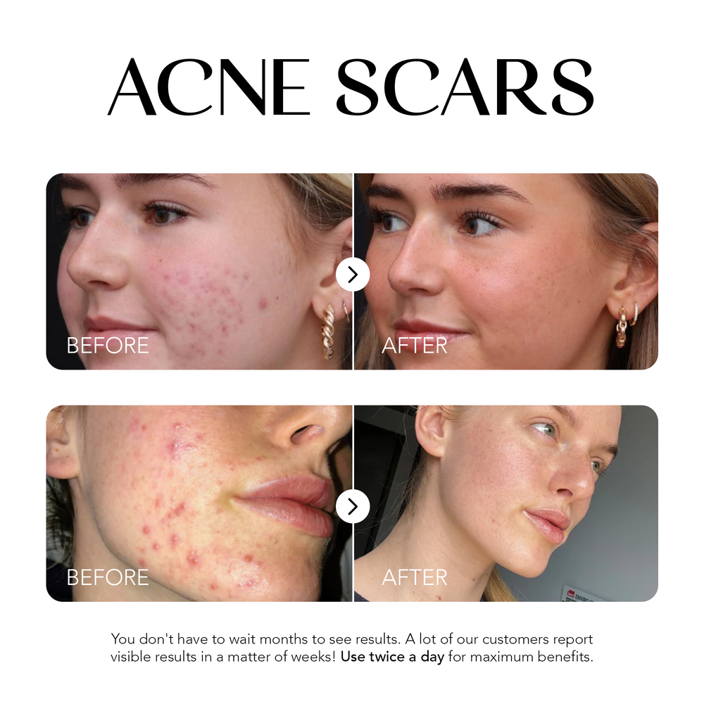 Dark Spot Corrector
