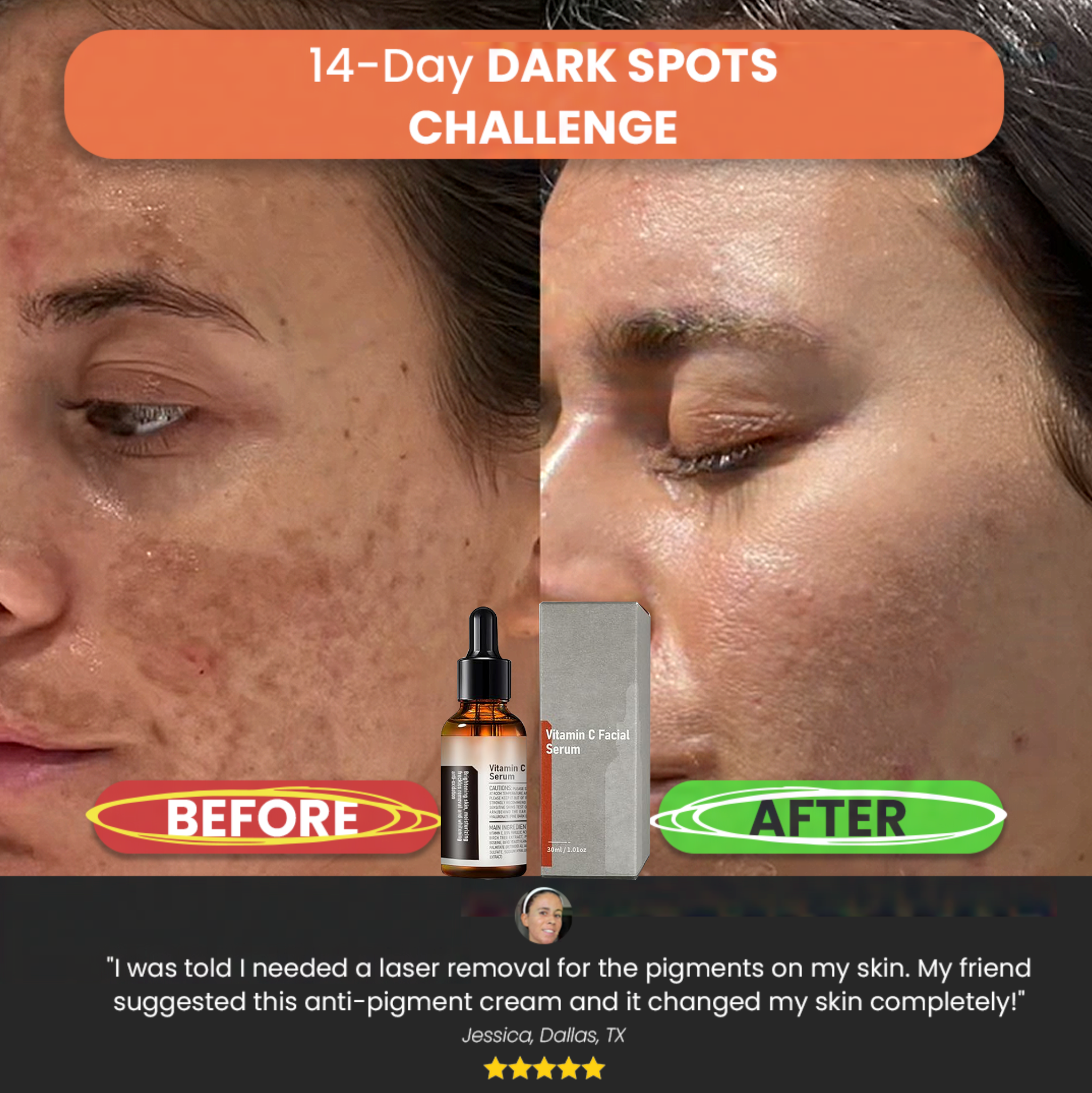 【Dermatologist-Recommended】 VC Spot-Correction & Whitening Cream Set