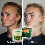 Koreanische Hautpflege-Toner-Pads – Anti-Aging, Pflege gegen dunkle Flecken und Falten mit Schneckenschleim und Peptiden (100 Stück)