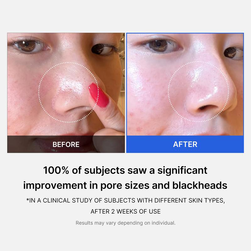 Mirco Pore Pads (AHA + BHA) | Cuidado de la piel propensa al acné