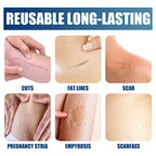 Scar Cream Gel, Advanced Silicone Scar Gel For Keloid, Hypertrophic, Surgical Scars & Stretch Marks